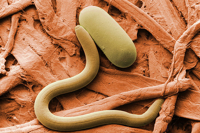 Experts: Watch For Soybean Cyst Nematode This Spring