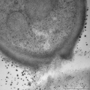 Stockton photomicroscopy of diseased cell rupture by Timorex Gold plant extract-based biofungicide.. Photo Credit: STK Bio-Ag Technologies