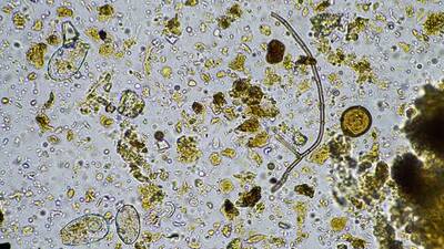 Moa and NAICONS Partner to Discover the Next Generation of Naturally-Occurring Herbicides